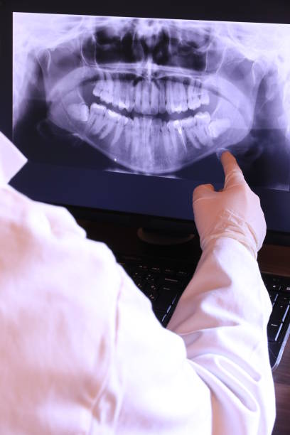 Best Emergency Root Canal Treatment in Big Lake, TX