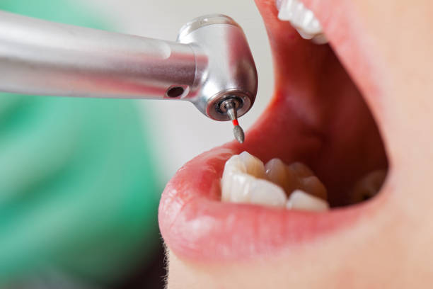 Best Pediatric Emergency Dentist in Big Lake, TX